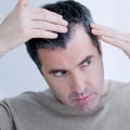 How Hair Fibers Can Help You Land Your Dream Job