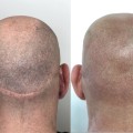 How to Master Scalp Camouflage Techniques for Job Seekers