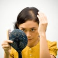 Iron-Deficiency Anemia and Hair Loss: Causes and Solutions