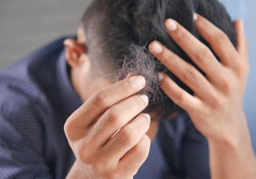 The Link Between Stress and Hair Loss: What You Need to Know