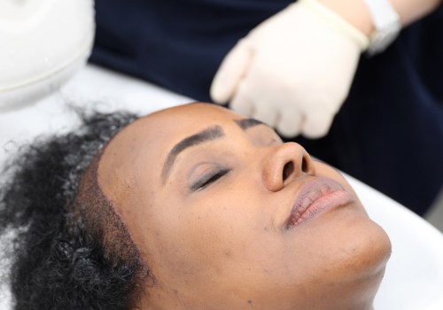 Hair Transplants: A Comprehensive Guide to Finding Job Opportunities