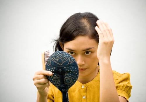 Iron-Deficiency Anemia and Hair Loss: Causes and Solutions