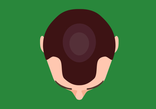 All You Need to Know About Finasteride: The Ultimate Guide to Finding Jobs Online